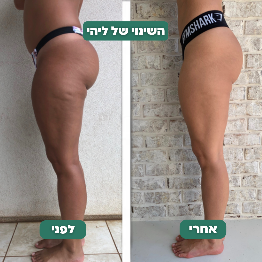 מכשיר להעלמת צלוליט - CelluPro™